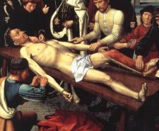 The Judgement of Camyses depicts a man being flayed alive